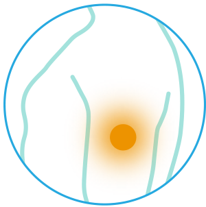 upper-arm