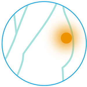 upper-buttock
